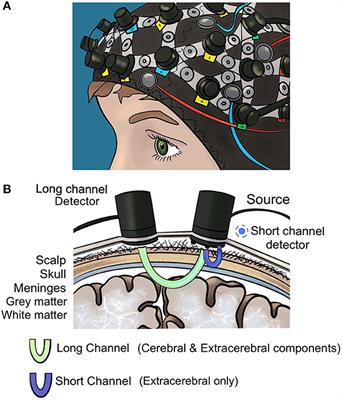 Optical neuroimaging and neurostimulation in surgical training and assessment: A state-of-the-art review